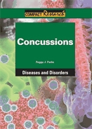 Concussions